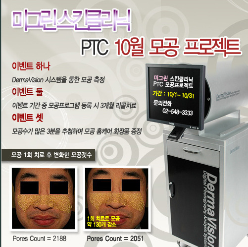 미그린 이미지